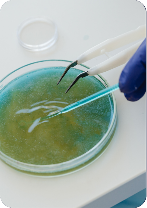 Escherichia coli